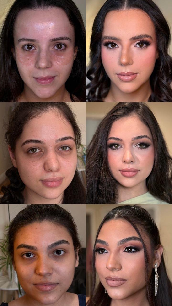 Before and After